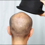 bald man with hat