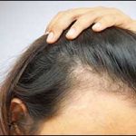 Boston Hair Solutions for Women