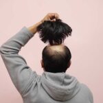 cause of hair loss in men