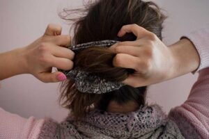 causes of thinning hair in women