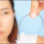 Greater Boston Excessive Hair Loss in Women