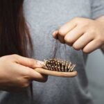 female hair loss in new bedford