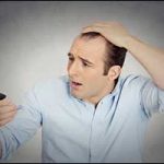 Greater Boston Male Pattern Baldness