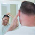 male pattern baldness solutions
