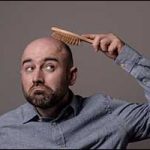 south coast hair loss men