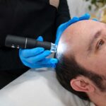customized treatment for male pattern baldness