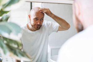 treatment for hair loss in New Bedford