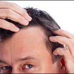 Greater Boston Area Hair Loss for Men