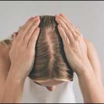 Greater Boston Hair Loss Women